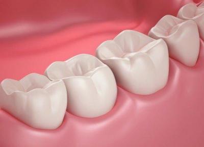 بهبود عملکرد ایمپلنت دندانی توسط محققان دانشگاه امیرکبیر