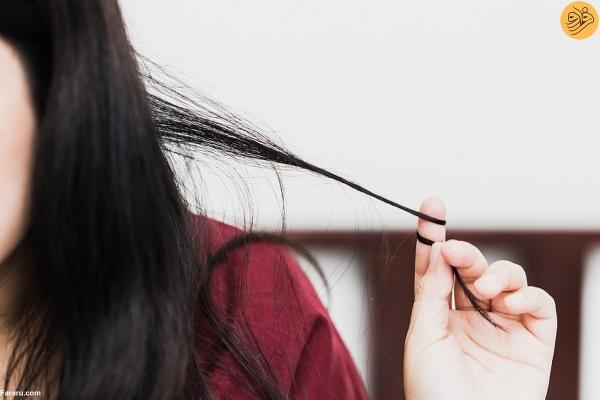 تریکوتیلومانیا یا اختلال کندن مو چیست؟